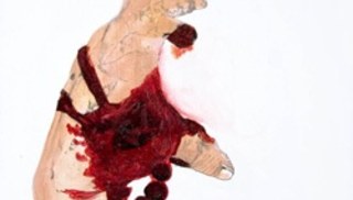 Whitney Bedford - Broken Hand #1